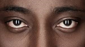 NEGRO 1. IMAGEN BBC